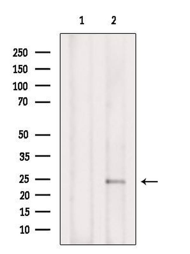 Phospho-TPT1 (Ser46) Antibody in Western Blot (WB)