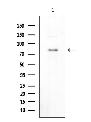 Phospho-MECP2 (Ser80) Antibody in Western Blot (WB)