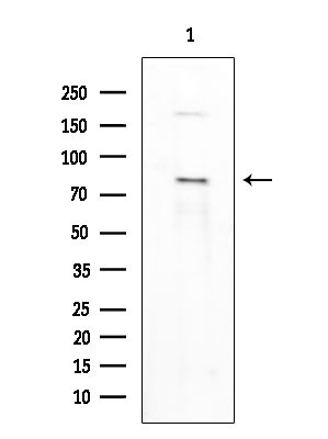 Phospho-MECP2 (Ser80) Antibody in Western Blot (WB)