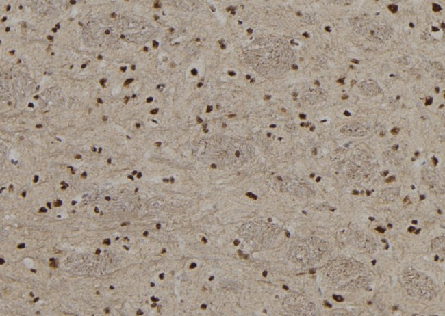 Phospho-MECP2 (Ser80) Antibody in Immunohistochemistry (Paraffin) (IHC (P))