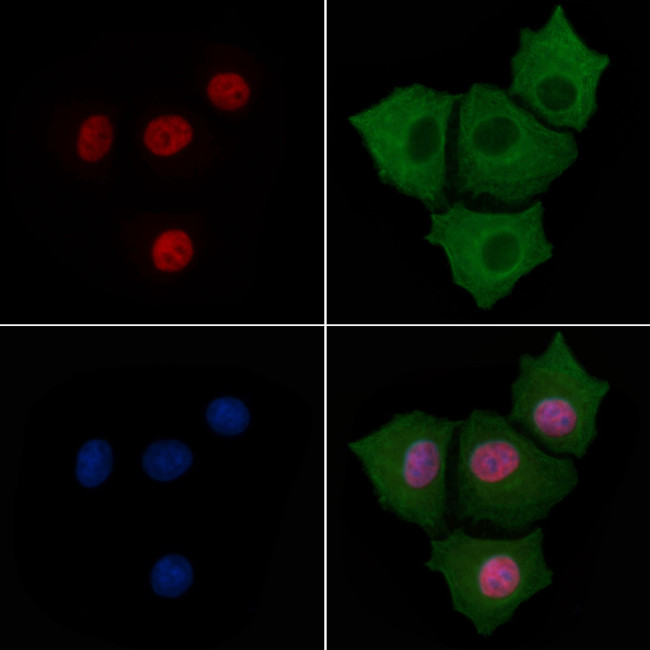 Phospho-KLF4 (Ser254) Antibody in Immunocytochemistry (ICC/IF)