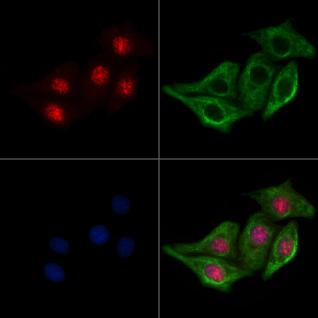 Phospho-CDK6 (Tyr24) Antibody in Immunocytochemistry (ICC/IF)