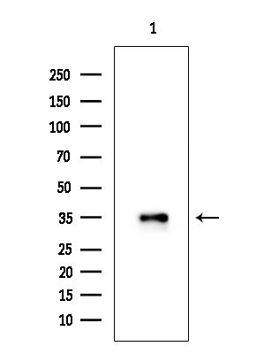 Phospho-CDK6 (Tyr24) Antibody in Western Blot (WB)