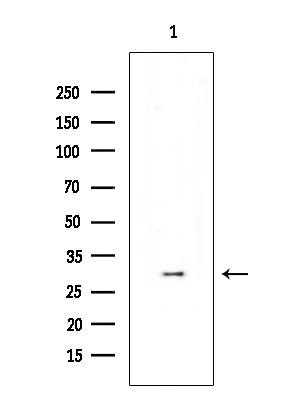 Phospho-CDK6 (Tyr24) Antibody in Western Blot (WB)