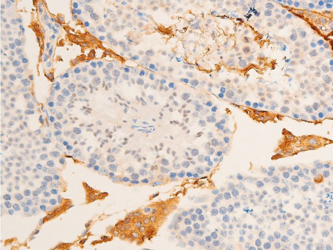 Phospho-IkappaB epsilon (Ser161) Antibody in Immunohistochemistry (Paraffin) (IHC (P))