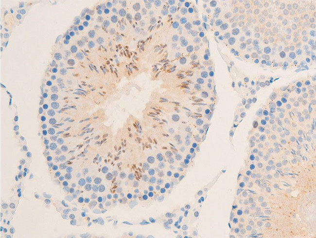 Phospho-IkappaB epsilon (Ser161) Antibody in Immunohistochemistry (Paraffin) (IHC (P))