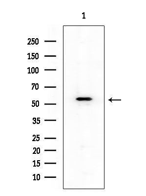 Phospho-Chk1 (Ser286) Antibody in Western Blot (WB)