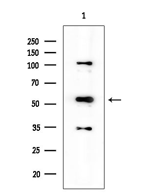 Phospho-Chk1 (Ser286) Antibody in Western Blot (WB)