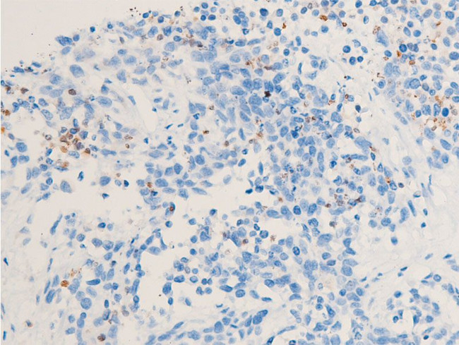 Phospho-Chk1 (Ser286) Antibody in Immunohistochemistry (Paraffin) (IHC (P))