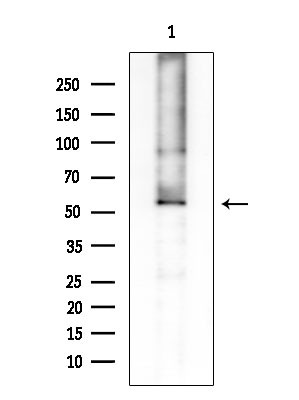 Phospho-Chk1 (Ser301) Antibody in Western Blot (WB)
