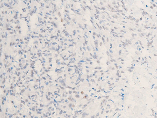 Phospho-Chk1 (Ser301) Antibody in Immunohistochemistry (Paraffin) (IHC (P))