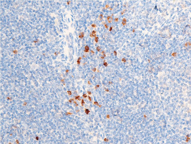 Phospho-Chk1 (Ser301) Antibody in Immunohistochemistry (Paraffin) (IHC (P))