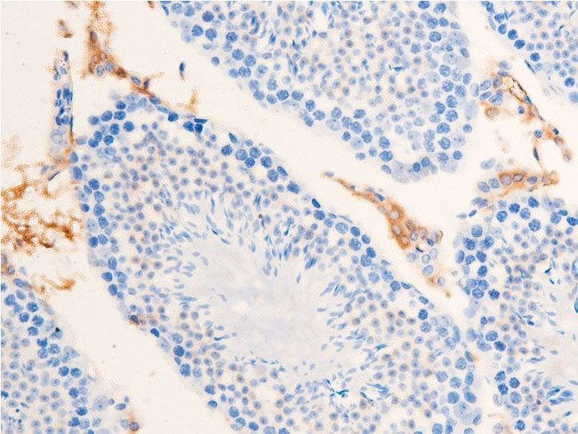 Phospho-Chk1 (Ser301) Antibody in Immunohistochemistry (Paraffin) (IHC (P))