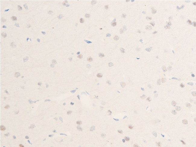 Phospho-Chk1 (Ser301) Antibody in Immunohistochemistry (Paraffin) (IHC (P))