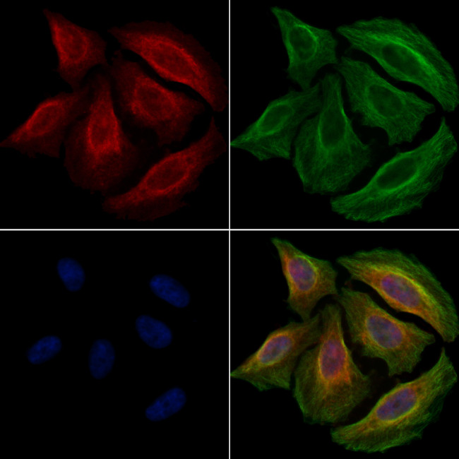 Phospho-IKK beta (Tyr188) Antibody in Immunocytochemistry (ICC/IF)