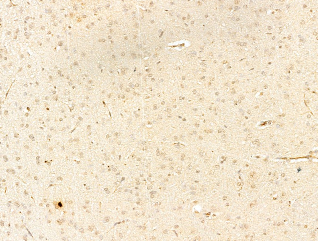 Phospho-IKK beta (Tyr188) Antibody in Immunohistochemistry (Paraffin) (IHC (P))