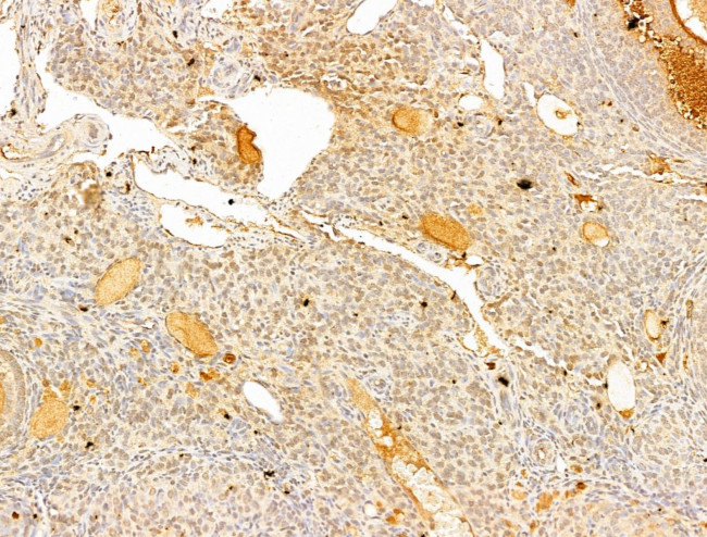 Phospho-IKK beta (Tyr188) Antibody in Immunohistochemistry (Paraffin) (IHC (P))