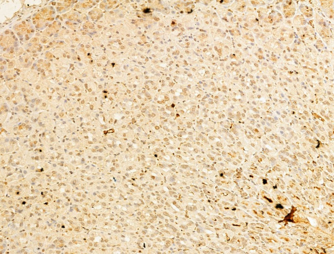 Phospho-IKK beta (Tyr188) Antibody in Immunohistochemistry (Paraffin) (IHC (P))