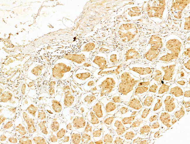 Phospho-IKK beta (Tyr188) Antibody in Immunohistochemistry (Paraffin) (IHC (P))