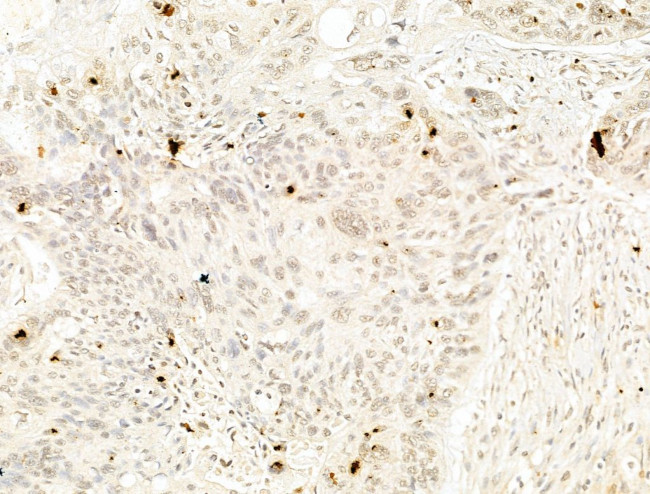 Phospho-IKK beta (Tyr188) Antibody in Immunohistochemistry (Paraffin) (IHC (P))