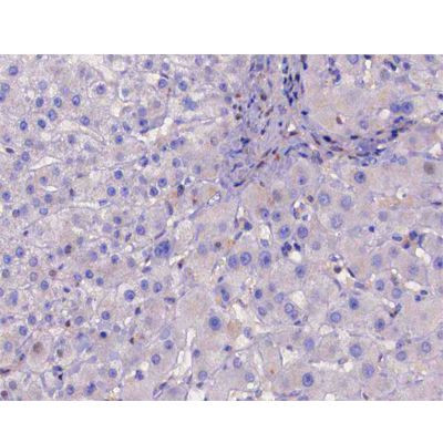 Phospho-IKK beta (Tyr188) Antibody in Immunohistochemistry (Paraffin) (IHC (P))