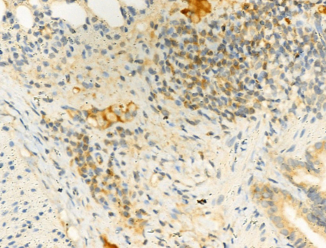 Phospho-IKK alpha/beta (Ser180, Ser181) Antibody in Immunohistochemistry (Paraffin) (IHC (P))