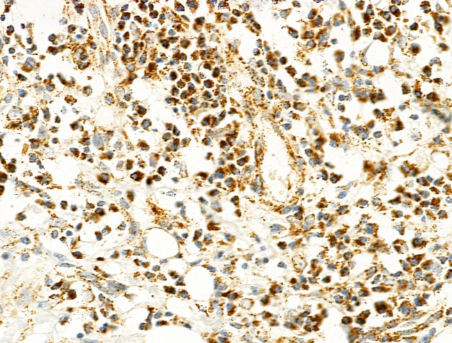 Phospho-IKK alpha/beta (Ser180, Ser181) Antibody in Immunohistochemistry (Paraffin) (IHC (P))