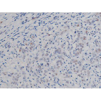 Phospho-IKK alpha/beta (Ser180, Ser181) Antibody in Immunohistochemistry (Paraffin) (IHC (P))