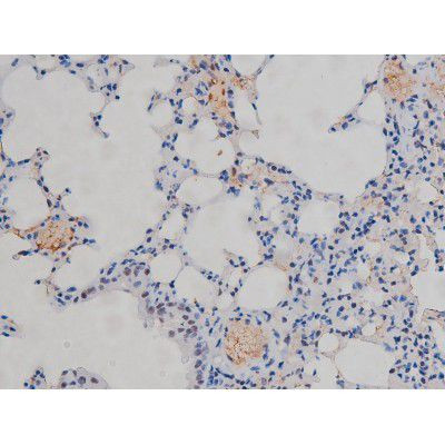 Phospho-IKK alpha/beta (Ser180, Ser181) Antibody in Immunohistochemistry (Paraffin) (IHC (P))