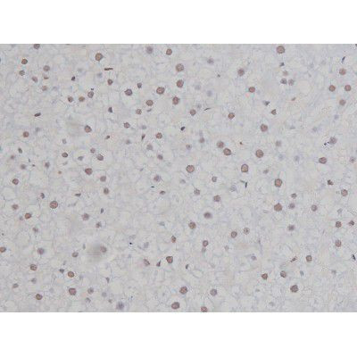 Phospho-IKK alpha/beta (Ser180, Ser181) Antibody in Immunohistochemistry (Paraffin) (IHC (P))