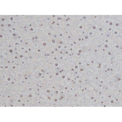 Phospho-IKK alpha/beta (Ser180, Ser181) Antibody in Immunohistochemistry (Paraffin) (IHC (P))