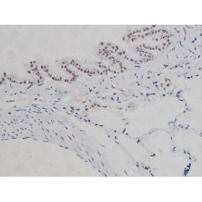 Phospho-IKK alpha/beta (Ser180, Ser181) Antibody in Immunohistochemistry (Paraffin) (IHC (P))