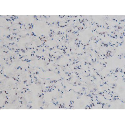 Phospho-IKK alpha/beta (Ser180, Ser181) Antibody in Immunohistochemistry (Paraffin) (IHC (P))