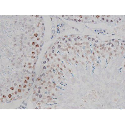 Phospho-IKK alpha/beta (Ser180, Ser181) Antibody in Immunohistochemistry (Paraffin) (IHC (P))