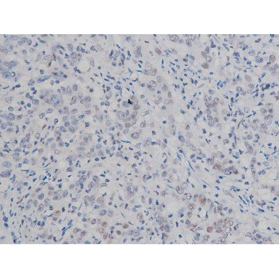 Phospho-IKK alpha/beta (Ser180, Ser181) Antibody in Immunohistochemistry (Paraffin) (IHC (P))