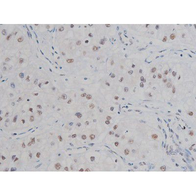 Phospho-IKK alpha/beta (Ser180, Ser181) Antibody in Immunohistochemistry (Paraffin) (IHC (P))