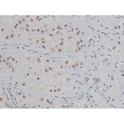 Phospho-IKK alpha/beta (Ser180, Ser181) Antibody in Immunohistochemistry (Paraffin) (IHC (P))