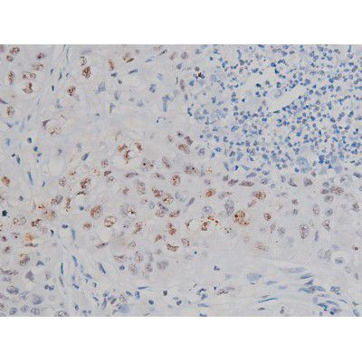 Phospho-IKK alpha/beta (Ser180, Ser181) Antibody in Immunohistochemistry (Paraffin) (IHC (P))