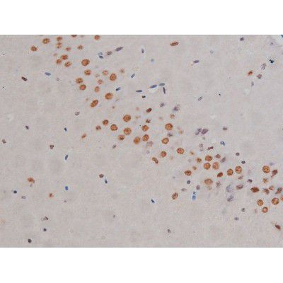 Phospho-IKK alpha/beta (Ser180, Ser181) Antibody in Immunohistochemistry (Paraffin) (IHC (P))