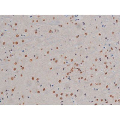 Phospho-IKK alpha/beta (Ser180, Ser181) Antibody in Immunohistochemistry (Paraffin) (IHC (P))