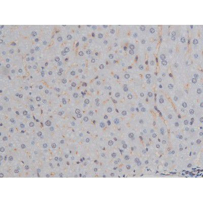 Phospho-IKK alpha/beta (Ser180, Ser181) Antibody in Immunohistochemistry (Paraffin) (IHC (P))