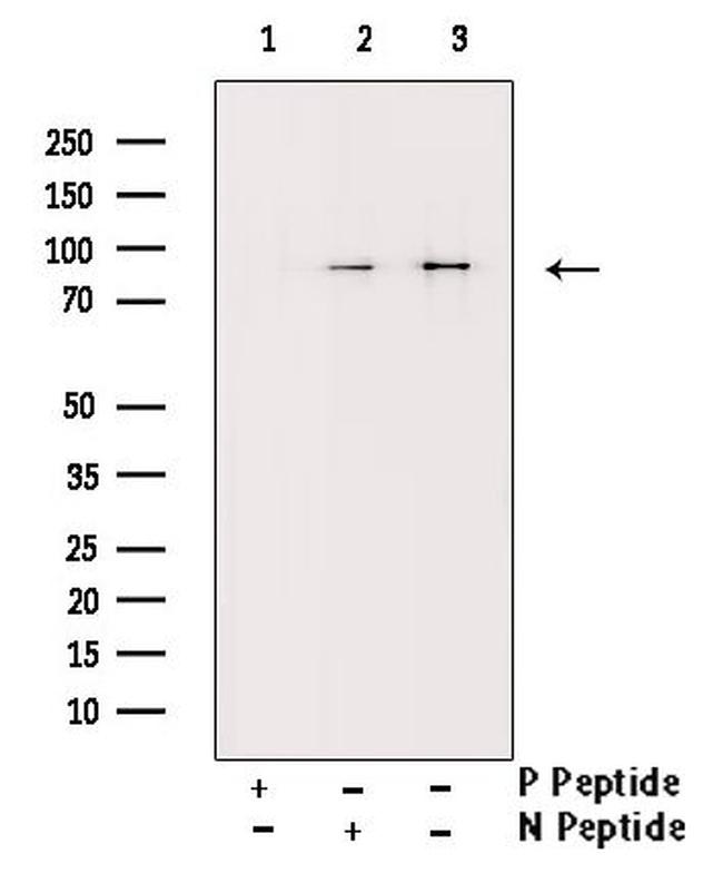 Phospho-IKK alpha/beta (Ser180, Ser181) Antibody in Western Blot (WB)