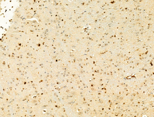 Phospho-IKK alpha/beta (Ser176, Ser177) Antibody in Immunohistochemistry (Paraffin) (IHC (P))