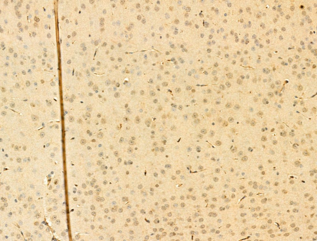 Phospho-IKK alpha/beta (Ser176, Ser177) Antibody in Immunohistochemistry (Paraffin) (IHC (P))