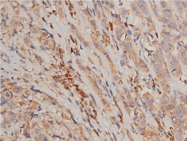 Phospho-IKK alpha/beta (Ser176, Ser177) Antibody in Immunohistochemistry (Paraffin) (IHC (P))