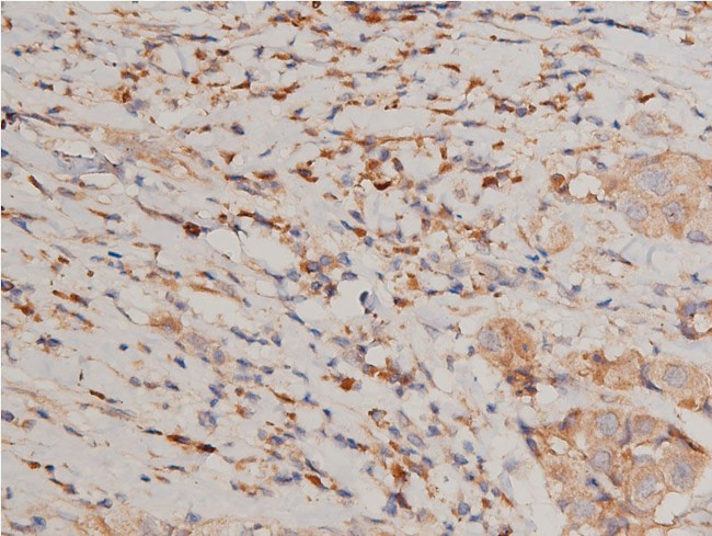 Phospho-IKK alpha/beta (Ser176, Ser177) Antibody in Immunohistochemistry (Paraffin) (IHC (P))