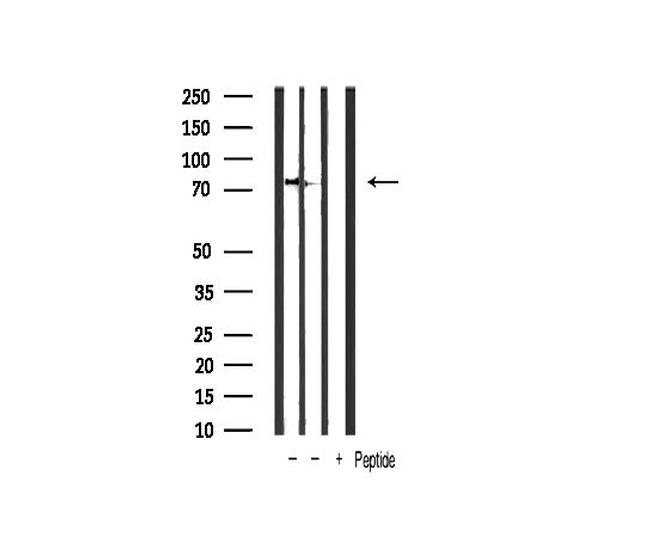 Phospho-IKK alpha/beta (Ser176, Ser177) Antibody in Western Blot (WB)