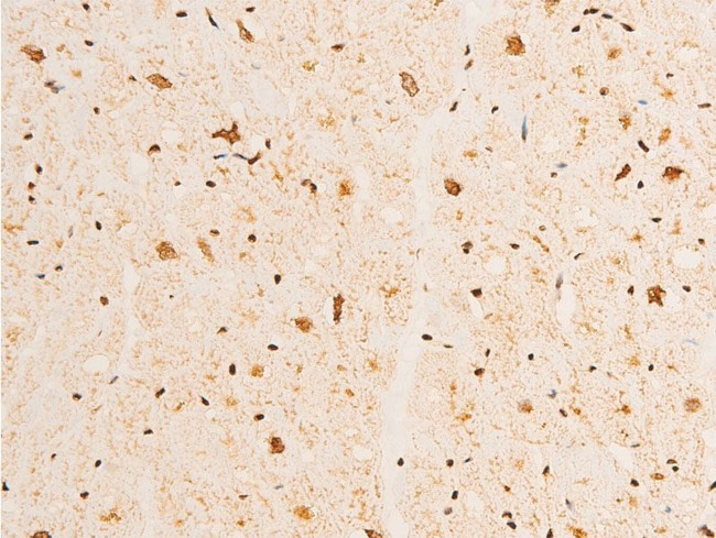 Phospho-p73 (Tyr99) Antibody in Immunohistochemistry (Paraffin) (IHC (P))