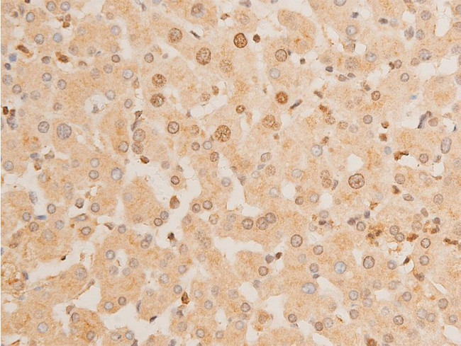 Phospho-p73 (Tyr99) Antibody in Immunohistochemistry (Paraffin) (IHC (P))