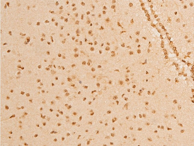 Phospho-p73 (Tyr99) Antibody in Immunohistochemistry (Paraffin) (IHC (P))